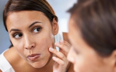 Seborrheic skin: oily, acne-prone, combination skin