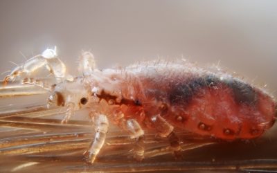 Pediculosis and natural lice treatments