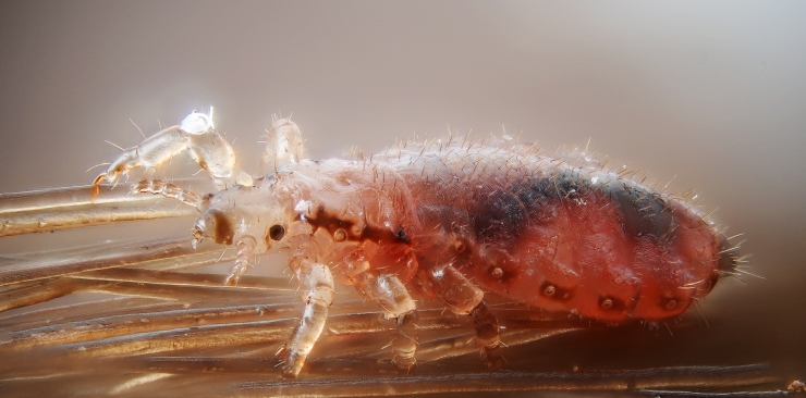 Pediculosis and natural lice treatments