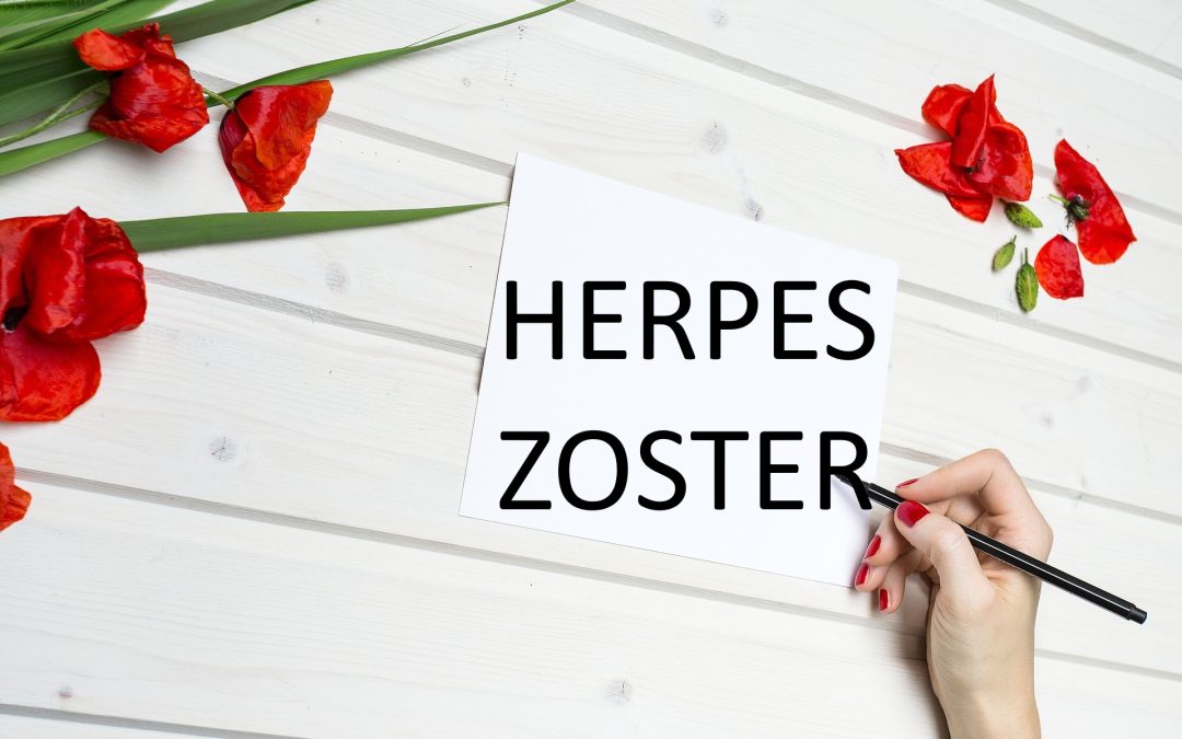 herpes zoster